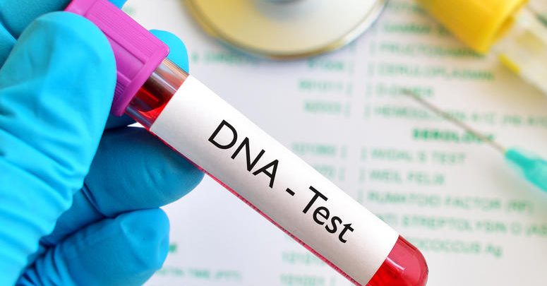 آزمایش دی ان ای DNA