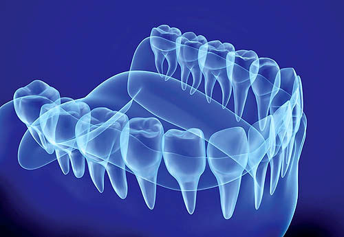 چاپگر سه بعدی دندان مصنوعی