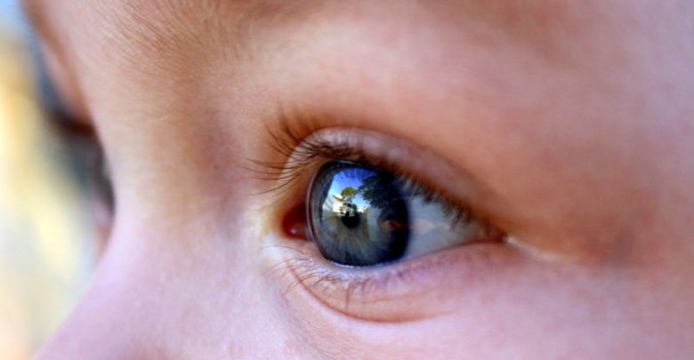  اپلیکیشنی که می‌تواند بیماری چشمی ‌را از روی عکس تشخیص دهد