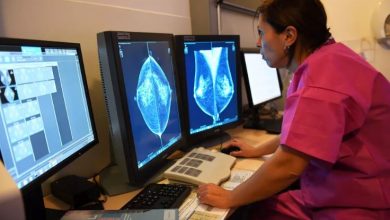 هوش مصنوعی گوگل در تشخیص سرطان سینه بهتر از انسان عمل می‌کند
