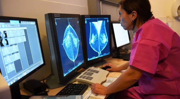 هوش مصنوعی گوگل در تشخیص سرطان سینه بهتر از انسان عمل می‌کند
