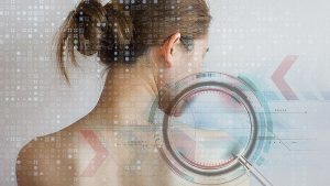 دقت بالای هوش مصنوعی در تشخیص سرطان پوست