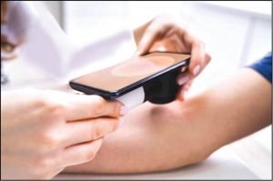 دقت بالای هوش مصنوعی در تشخیص سرطان پوست