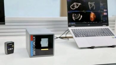ساخت کوچکترین دستگاه CT جهان با ۶ کیلوگرم وزن